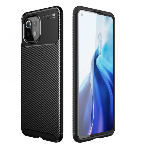 Xiaomi Mi 11 Lite Kılıf Zore Negro Silikon ürün görseli 1