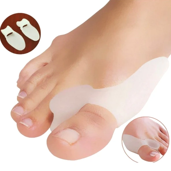 Ayak Başparmak Kemik Koruyucu Halluks Valgus Parmak Koruyucu Kemik Çıkıntısı Önleyici ürün görseli 1
