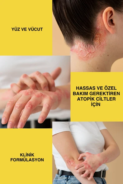 Sülfax Kükürt Vücut Kremi 100ml - Resim 5