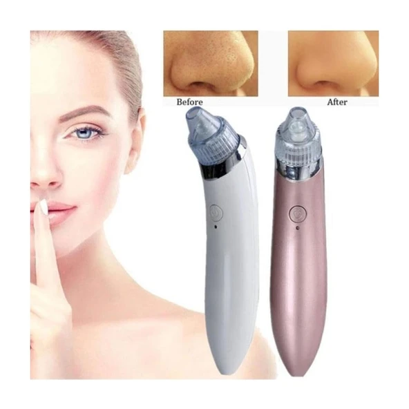 MUJGAN XN-8030 Profesyonel Vakumlu Siyah Nokta ve Temizleme Şarjlı ürün görseli 1
