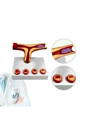 Medikaltec Damar Tıkanıklığı Model46 – D - Medikaltec Damar Tıkanıklığı Model46 ürün görseli 1