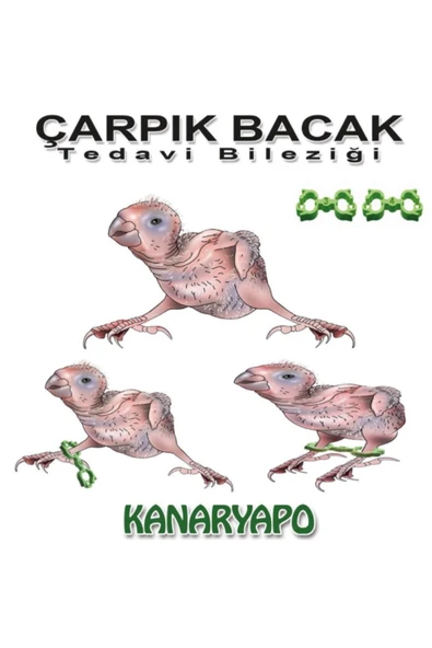 Kanaryapo Çarpık Bacak Tedavi Bileziği Muhabbet ürün görseli 1