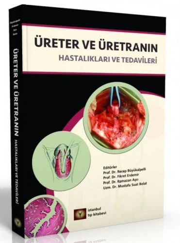Üreter ve Üretranın Hastalıkları ve Tedavileri ürün görseli 1