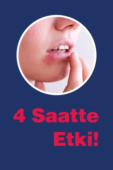 Tto Ux Uçuk Kremi 10ml - Resim 3