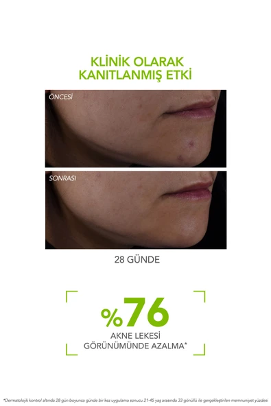 BİODERMA Sebıum Serum - Resim 3