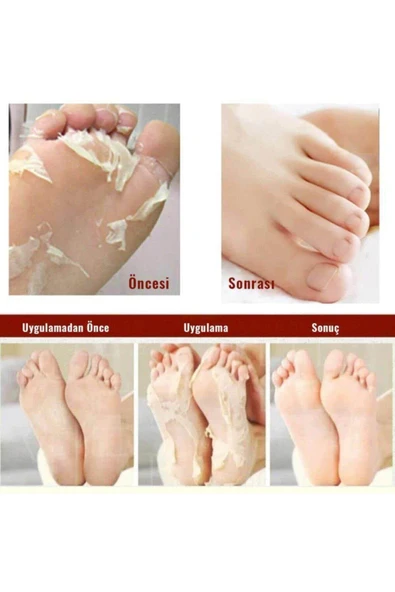 Miracle Foot Peeling Pack-çorap Tipi Ayak Peeling Maskesi - Resim 3