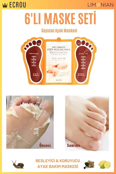 Soyulan Ayak Peeling Maskesi 6 Lı - Resim 5