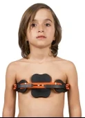 wingmed WP954 Pectus Carinatum Ortezi Asimetrik ürün görseli 1