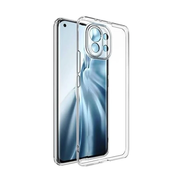 Xiaomi Mi 11 Lite Lux Seri Premium Şeffaf Silikon Kılıf ürün görseli 1