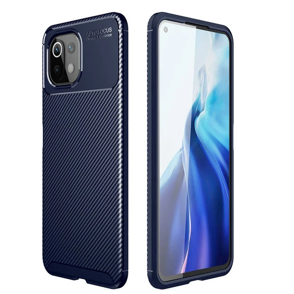 Zore Xiaomi ile uyumlu Mi 11 Lite Kılıf Negro Silikon Kapak ürün görseli 1