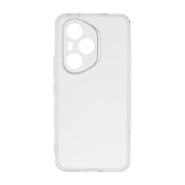 Zore Honor 400 Pro 2mm Anti Shock Silikon - Resim 4