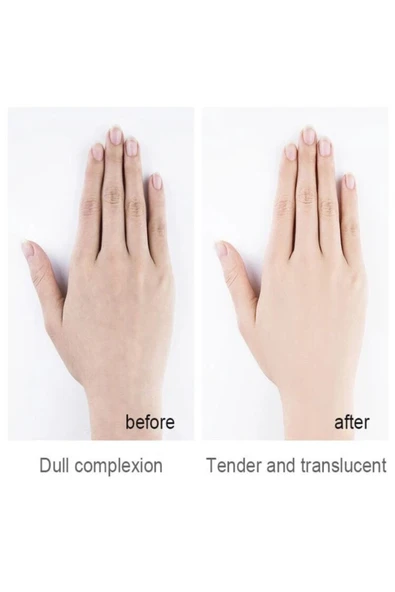 MÖOYAM Niacinamide Keçi Sütü El Maskesi - Resim 5