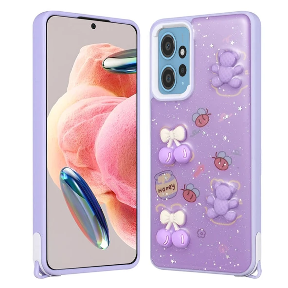 Moby Shop Redmi Note 12 4G Kılıf Lunessa Premium Figürlü Sert Silikon Kapak ürün görseli 1
