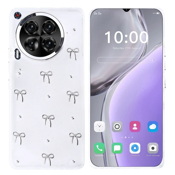 Moby Shop Tecno Camon 30 4G Uyumlu Şık Mini Figürlü Ucay Premium Sert Silikon Kapak ürün görseli 1
