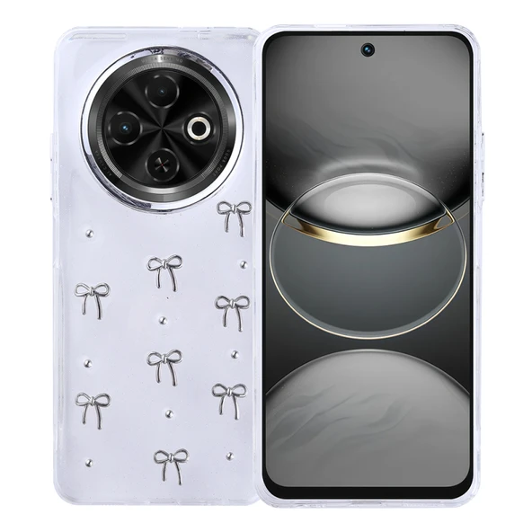 Moby Shop Tecno Spark 30C Uyumlu Şık Mini Figürlü Ucay Premium Sert Silikon Kapak ürün görseli 1
