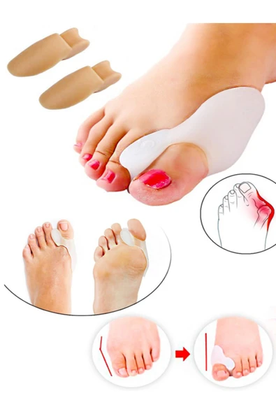 Bunion Kemik Koruyucu Baş Parmak ürün görseli 1