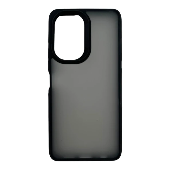 Nettech Oneplus Nord Ce Lite Uyumlu NT-N049 Arka Koruma Kılıf NT-109027 ürün görseli 1