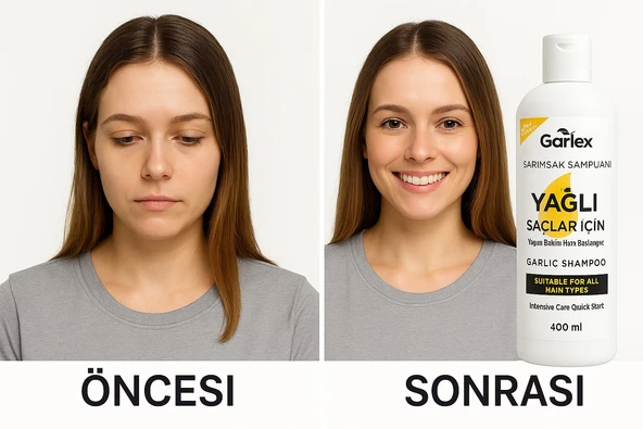 Garlex Sarımsak Şampuanı Yağlı Saçlar İçin 250 ml ürün görseli 1