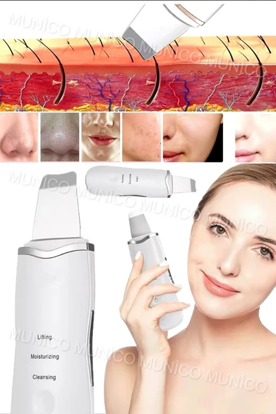 Munico Ultrasonik Yüz Temizleyici - Akne Giderme Cihazı, Peeling Spatula Beyaz Derinlemesine Temizlik İçin ürün görseli 1