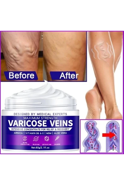 Xlan Maximum Strength Varicose Veins Krem 100 ml 1 Adt - Resim 2