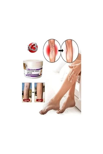 Xlan Varicose And Spider Veins Soothing Leg Cream Bacak Bakım Kremi 100 ml x 3 Adet ürün görseli 1