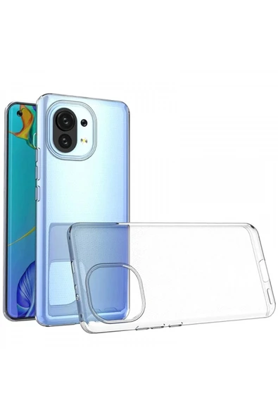 Xiaomi Mi 11 Kılıf Lüx Şeffaf Silikon-(5796) ürün görseli 1