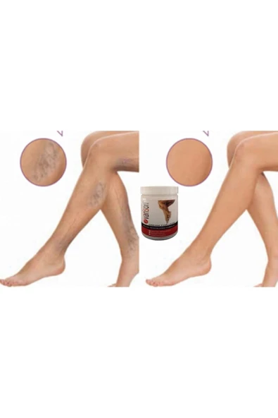 Varison Va.ris Selü.lit Bacak Bakım Kremi 200 ml X 2adet - Resim 2