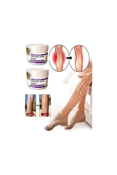 Varicose And Spider Veins Soothing Leg Cream Bacak Bakım Kremi 100 ml x 2 Adet ürün görseli 1
