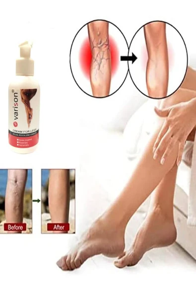 On  Sellülit Bacak Bakım Kremi 120 ml - Resim 2