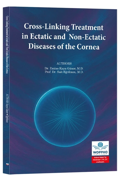 Cross-Linking Treatment in Ectatic and Non-Ectatic Diseases of the Cornea ürün görseli 1