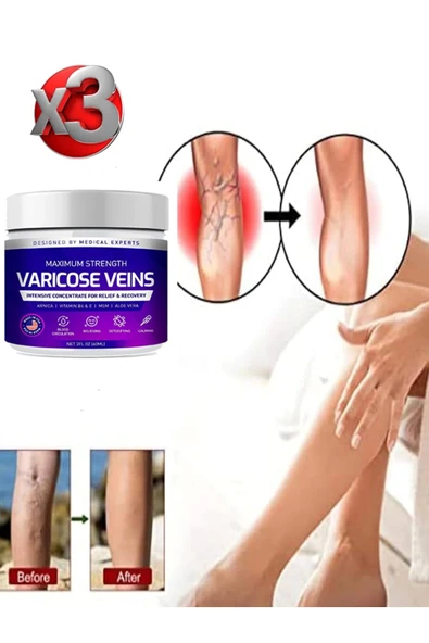 Süper Maximum Strength Varicose Veins Bakım Kremi 100 ml x 3 adet ürün görseli 1