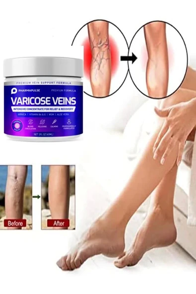 Süper Maximum Strength Varicose Vein Var.is Bacak Bakım Masaj Kremi 100 ml x 2 adet ürün görseli 1