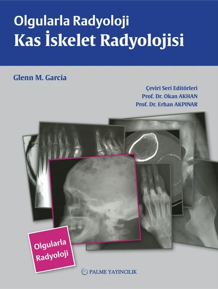Palme Yayınevi Olgularla Radyoloji Kas İskelet Radyoloji ürün görseli 1