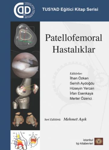 TUSYAD Eğitici Kitap Serisi - Patellofemoral Hastalıklar ürün görseli 1
