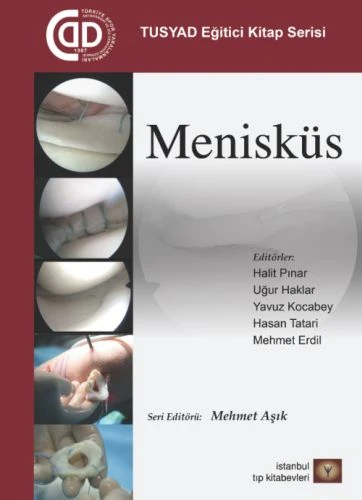TUSYAD Eğitici Eğitim Seti - Menisküs ürün görseli 1