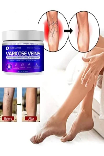 Maximum Strength Varicose Vein Var.is Bacak Bakım Masaj Kremi 100 ml 2 Adet ürün görseli 1