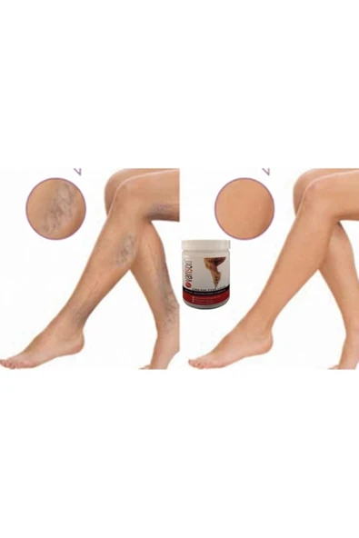 On  Selüllit Bacak Bakım Kremi 200 ml X 2adet - Resim 2