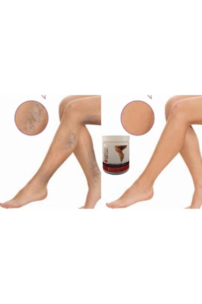 On  Selüllit Bacak Bakım Kremi 200 ml X 2adet - Resim 2
