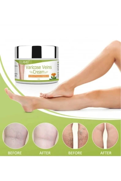 Varicose Veins Var.is Kremi 100 ML - Resim 2