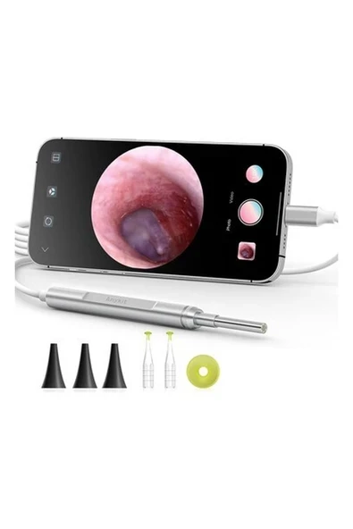 Anykit Dijital Otoskop, Ultra Net Görüşlü Kulak Kamerası - Ipad/iphone/android ürün görseli 1