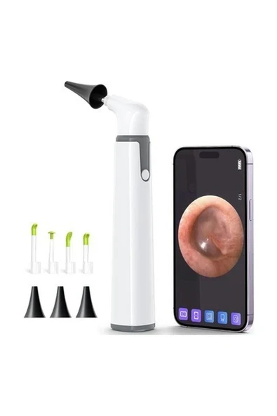 Scopearound Otoskop, Kulak Kiri Temizleme Aleti ile Birlikte - 3.9 mm ürün görseli 1