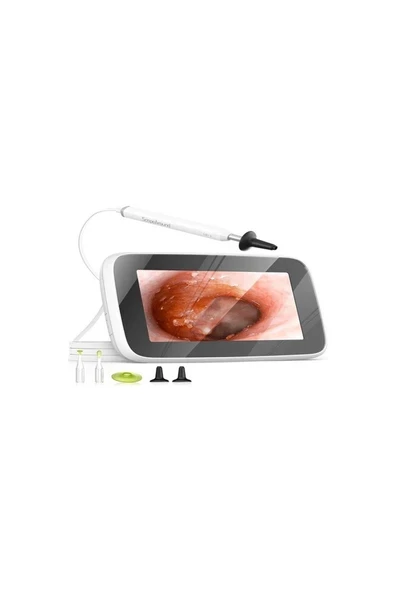 Scopearound Dijital Otoskop Işıklı, Kulak Temizleme Kamerası ürün görseli 1