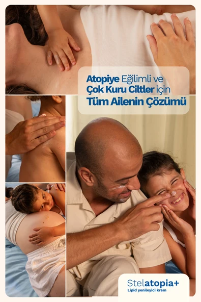 MUSTELA Stelatopia Cream 150 ml - Resim 2