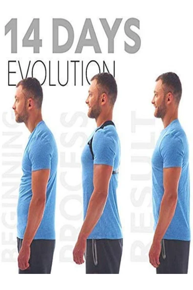 baffhome Yeni Nesil Dik Duruş Kamburluk Önleyici Unisex Korse, ürün görseli 1