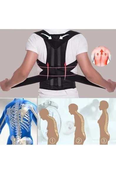 TUMKE Dik Duruş Korsesi Kadın Erkek Ayarlanabilir Medikal Sırt Korsesi Kamburluk Önleyici Korse ürün görseli 1