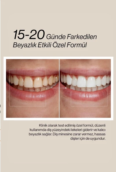 Misdent Bitki İçerikli & Mineralli Diş Macunu 75 ml - Resim 3