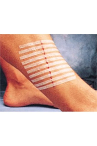 3m Steri-strip Dikiş Bantları 6mm X 100mm 10 Adet Şerit R1546 ürün görseli 1