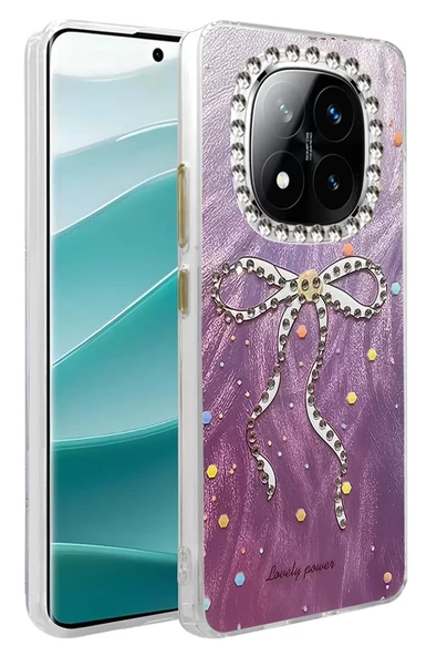 Newface Xiaomi Redmi Note 14 Pro 4G Kılıf Blade Aynalı Desenli Kapak - Desen 1 ürün görseli 1
