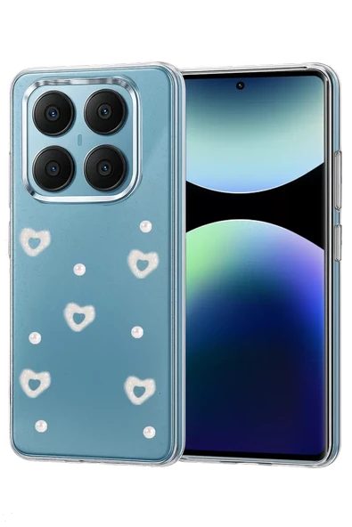 Newface Xiaomi Redmi Note 14 Pro 4G Fiyonk Desenli Kapak - Desen 10 ürün görseli 1