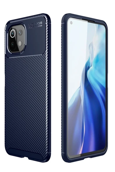 Newface Xiaomi Mİ 11 Lite Kılıf Auto Focus Karbon Kapak - Lacivert ürün görseli 1
